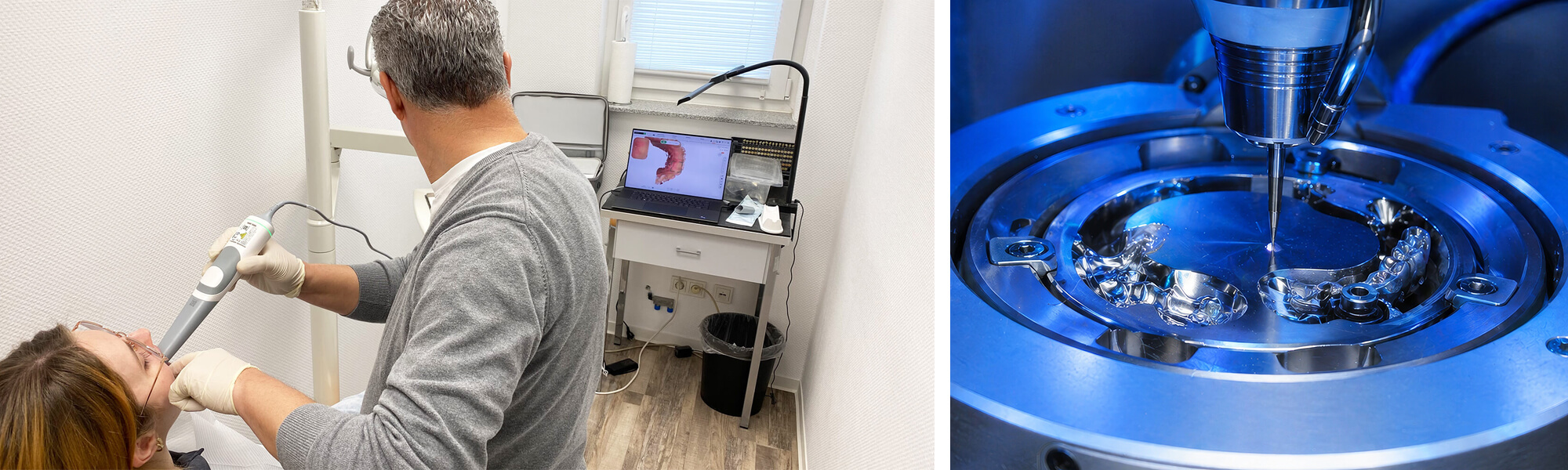 Collage zum Frässervice mit CAD-Planung, Zahnscan, Fräsmaschine und fertigem Zahnersatz