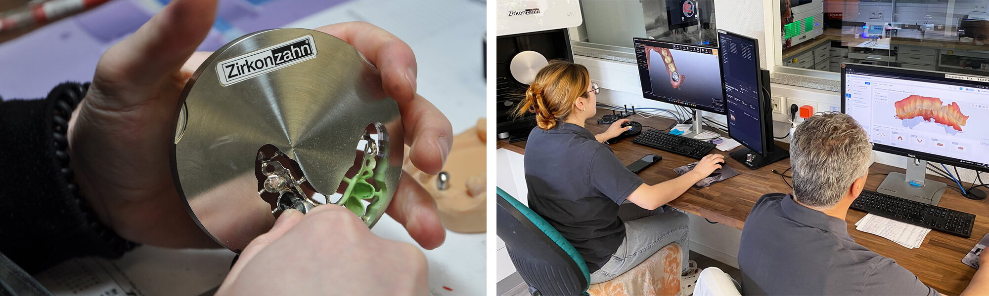 Digitaler Workflow vom Intraoralscan über CAD-Konstruktion bis zur gefrästen Zahnrestauration