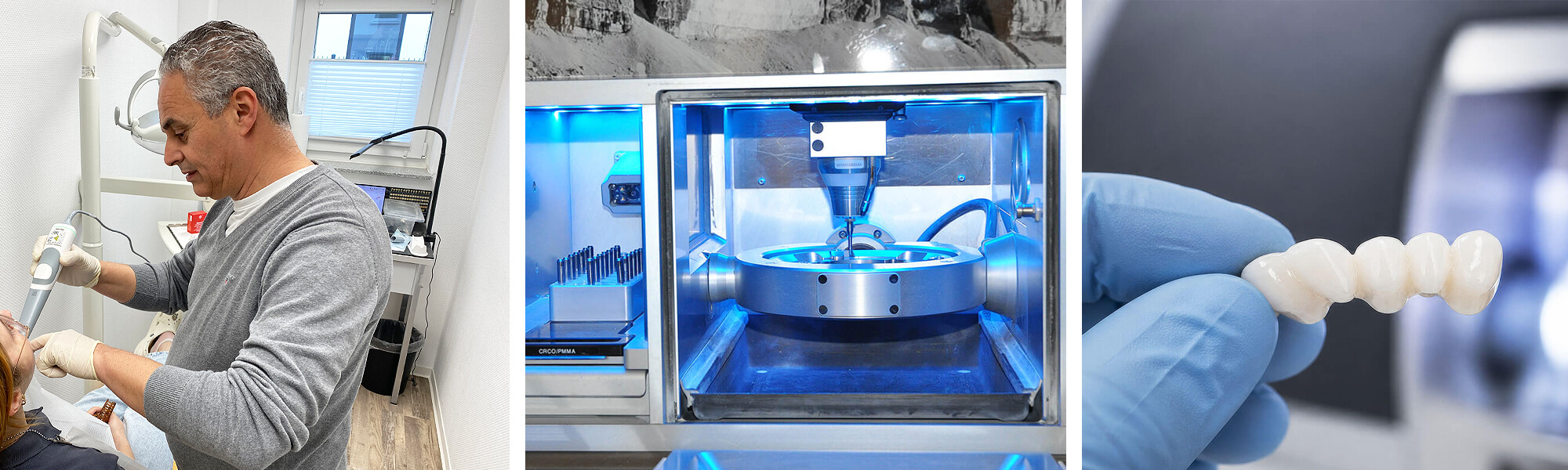CAD/CAM-Frässervice mit Intraoralscan, digitaler Planung, Fräseinheit und Zahnersatz