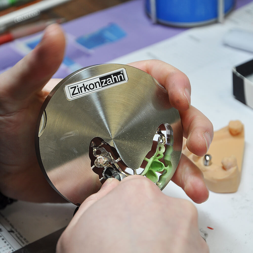 Zahntechniker bearbeitet eine Metallprothese auf einem Zirkonzahn-Fräsrohling mit feinem Werkzeug.