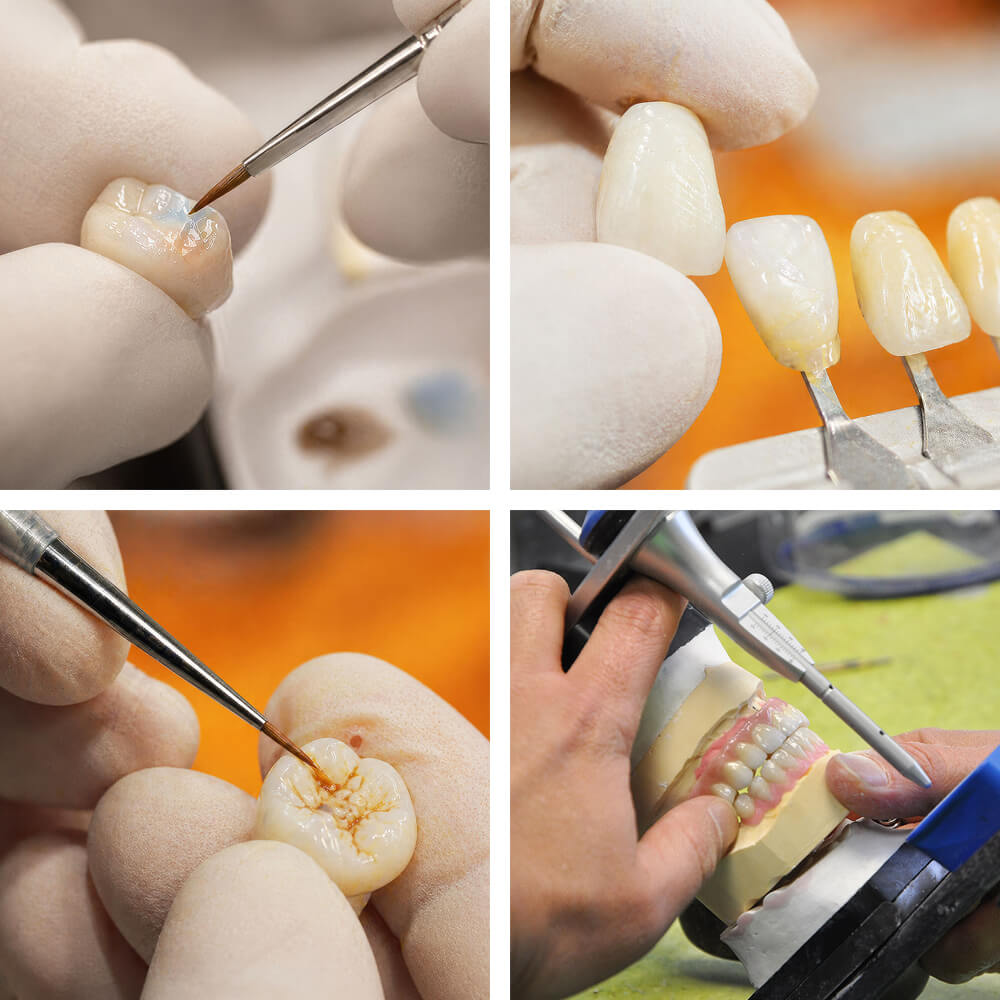 Bildcollage zur zahntechnischen Keramikbearbeitung mit Politur, Farbanpassung und Zahnfarbskala
