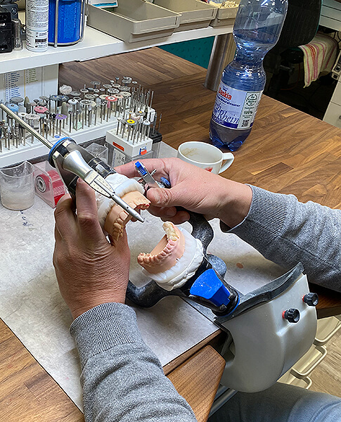 Zahntechniker bearbeitet ein Zahnmodell im Artikulator mit Handstück und Präzisionswerkzeug.